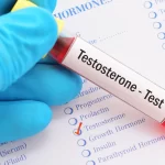 Top 7 At-Home Testosterone Testing Kits Reviewed