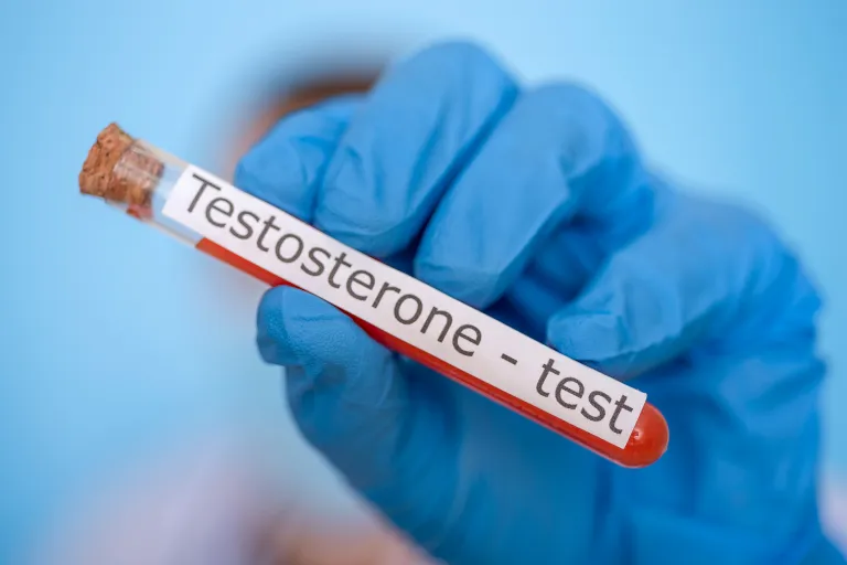 Comprehensive Guide to Testosterone Testing: Everything Men Should Know